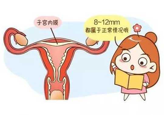 子宫内膜增生插图 子宫内膜增生插图