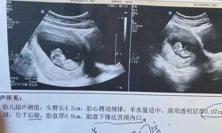 12周nt男宝特点是怎样的？nt单生男孩特征插图2