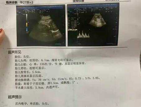 清宫查男查女表2024年准不准？看清宫表方法？插图