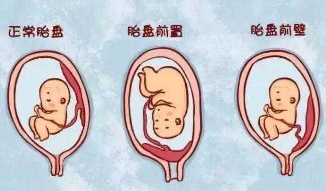 前壁男孩多还是后壁男孩多？前后壁有什么区别？插图2