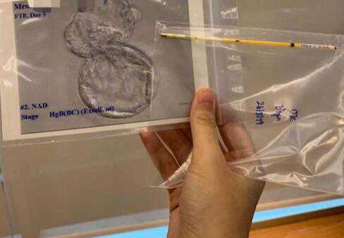 做试管男的需要打针吗？附详细试管流程？插图2