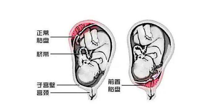 前壁男孩多还是后壁男孩多？前后壁有什么区别？插图1