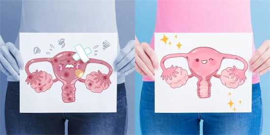 输卵管粘连会致不孕吗插图
