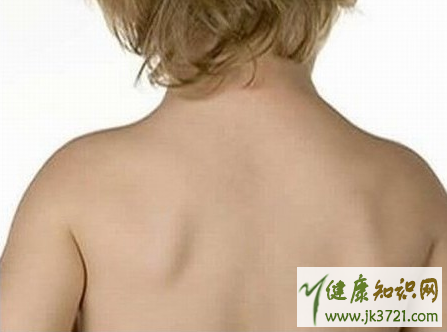 孩子驼背怎么办孩子驼背的锻炼方法插图1 孩子驼背怎么办孩子驼背的锻炼方法插图1