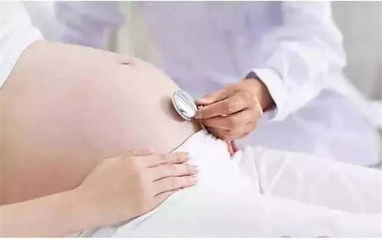 B超图自己判断胎儿性别怎么看?b超图看腿部间能看出生男生女吗插图 undefined