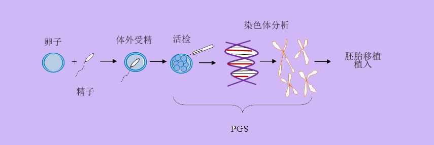 PGD在试管婴儿方面的运用插图 PGD在试管婴儿方面的运用插图