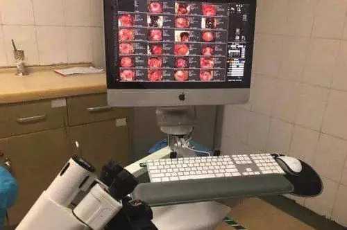 宫颈活检7天了还出血正常吗?宫颈活检一直出血怎么办?插图 宫颈活检7天了还出血正常吗?宫颈活检一直出血怎么办?插图