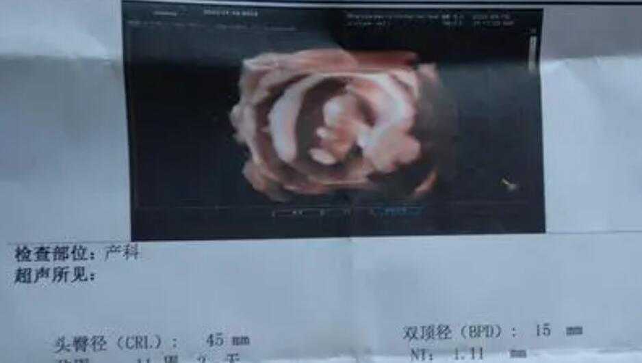 nt值看男孩女孩诀窍是什么？成功率高不高？插图1