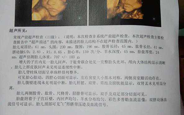 私人诊所可以做b超检查男女是真的吗？插图