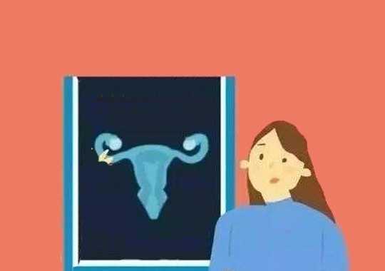 哪些人不要做输卵管造影?插图 哪些人不要做输卵管造影?插图