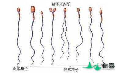 精子畸形偏方:如何改善99%精子畸形患者?插图 精子畸形偏方:如何改善99%精子畸形患者?插图