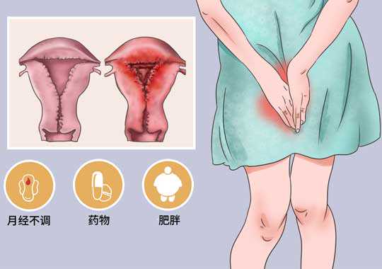 患子宫内膜增生症状表现插图 患子宫内膜增生症状表现插图