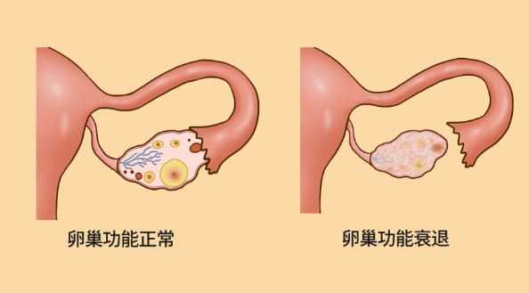 二代试管婴儿的配卵成功率插图 二代试管婴儿的配卵成功率插图