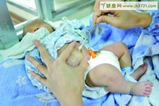 新生儿的肚脐如何护理？插图