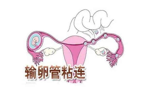 单身去泰国做试管婴儿，安全上需要注意什么插图