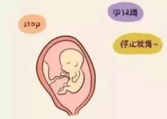单身女性去国外做试管婴儿的实用指南插图
