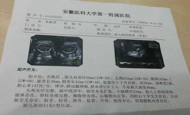 b超单有这个f标志是不是生女孩的概率很大？插图