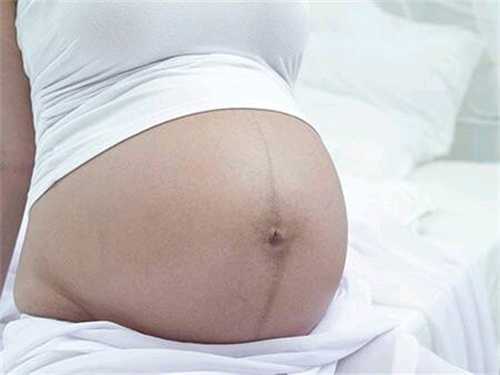 一条黑线看男女的方法汇总！黑线看男女的方法到底准不准插图1