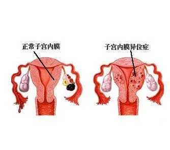 2022湖北做试管婴儿的医院排行？附医院排名清单插图