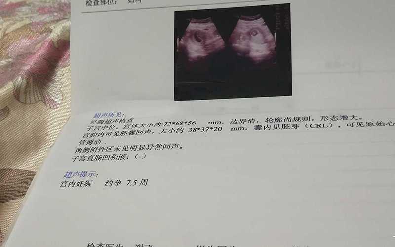 如何通过孕妇孕囊形状看男女? 据说怀孕测男女这个方法最准的98%插图