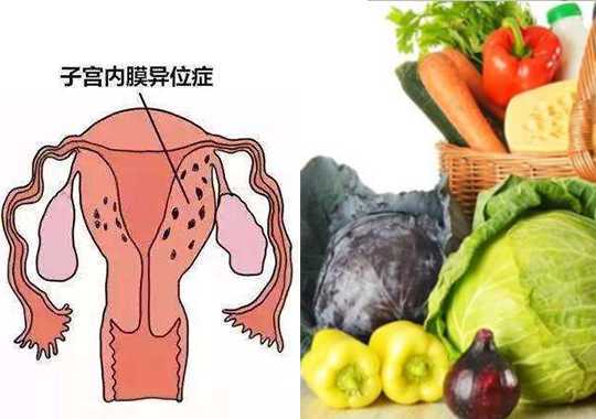 营养与子宫内膜异位插图