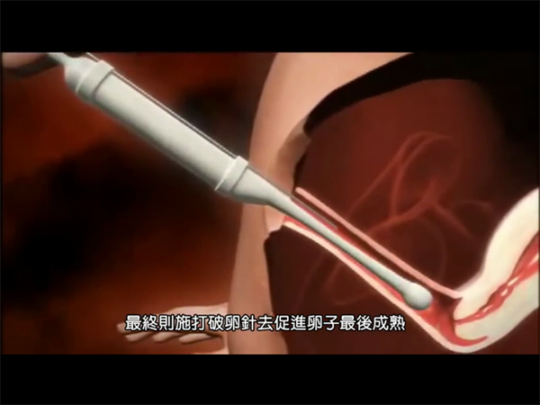 试管取卵后吃益玛欣的功效说明！附取卵后吃益玛欣的用法用量插图1