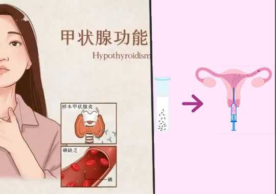 试管前为什么要查甲状腺?插图 试管前为什么要查甲状腺?插图
