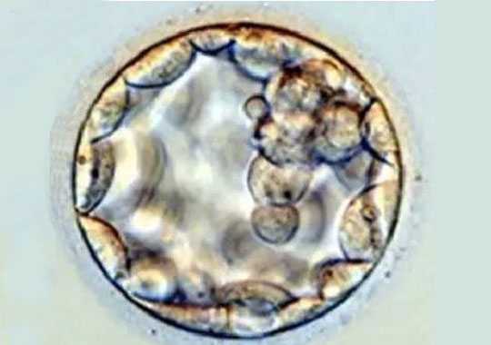什么是囊胚(blastula)?插图 什么是囊胚(blastula)?插图