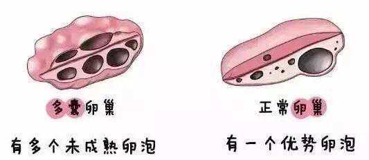 空卵泡与正常卵泡的区别，各自的特点是什么插图