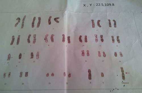 夫妻染色体检查费用需要多少钱?染色体检查项目都有哪些?插图 1658156816318801.jpeg