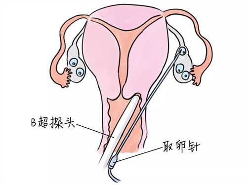 上海能做供卵试管的机构有哪些 如何选择正规的试管婴儿医院?插图 上海能做供卵试管的机构有哪些 如何选择正规的试管婴儿医院?插图
