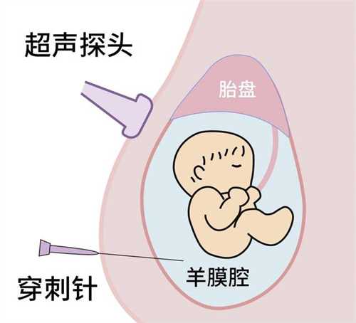 俄罗斯试管婴儿前的检查有哪些?俄罗斯试管婴儿技术如何?插图 俄罗斯试管婴儿前的检查有哪些?俄罗斯试管婴儿技术如何?插图