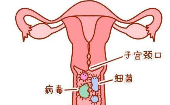 女性外阴瘙痒有异味是怎么回事?插图 1660270810495696.png