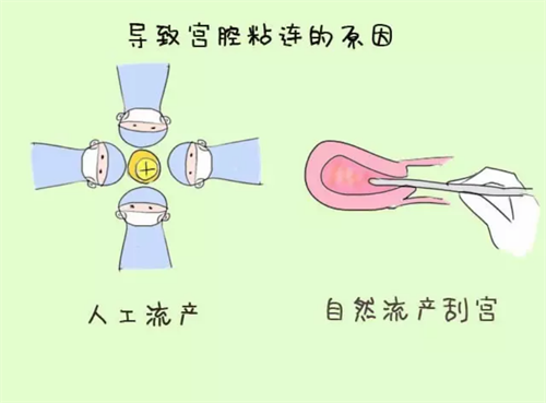做供卵试管三次移植全部失败?可能是这些原因导致供卵移植失败!插图 做供卵试管三次移植全部失败?可能是这些原因导致供卵移植失败!插图