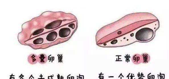 谣言粉碎机|促排卵后会加速卵巢衰老，是真的吗？插图2