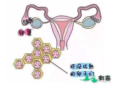 试管婴儿促排会不会造成卵巢早衰?插图1 试管婴儿促排会不会造成卵巢早衰?插图1