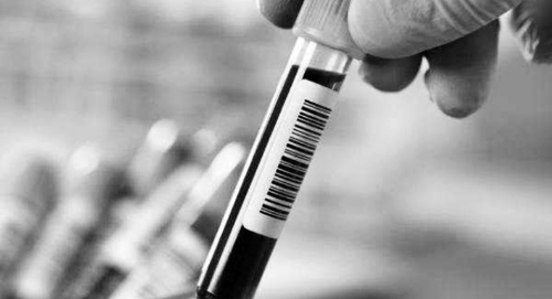 梅毒抗体筛查法常用有3种,确诊需要诊断区分插图