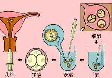 45岁做借卵试管成功率高不高?供卵多少岁做好?插图1 1658155854624145.jpeg