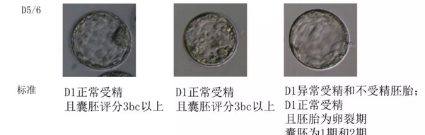 取卵和胚胎培养环节最重要？做试管婴儿的你一定不知道！插图8