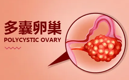 瘦的多囊卵巢患者是不是很难怀孕插图 瘦的多囊卵巢患者是不是很难怀孕插图