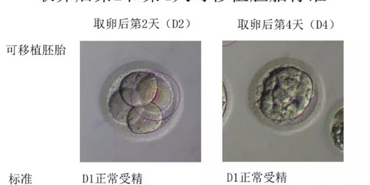 取卵和胚胎培养环节最重要？做试管婴儿的你一定不知道！插图6