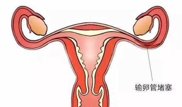 试管婴儿费具体包括哪些项目 惠州试管婴儿去哪家医院做好插图 试管婴儿费具体包括哪些项目 惠州试管婴儿去哪家医院做好插图