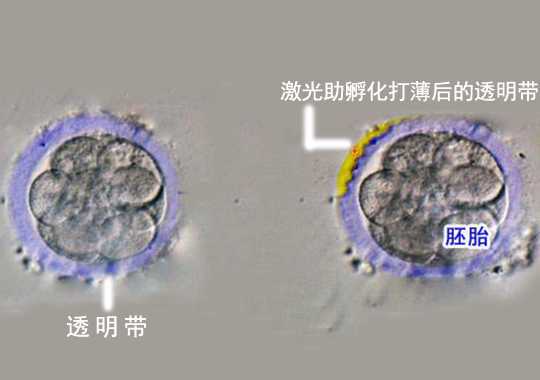 胚胎激光辅助孵化插图