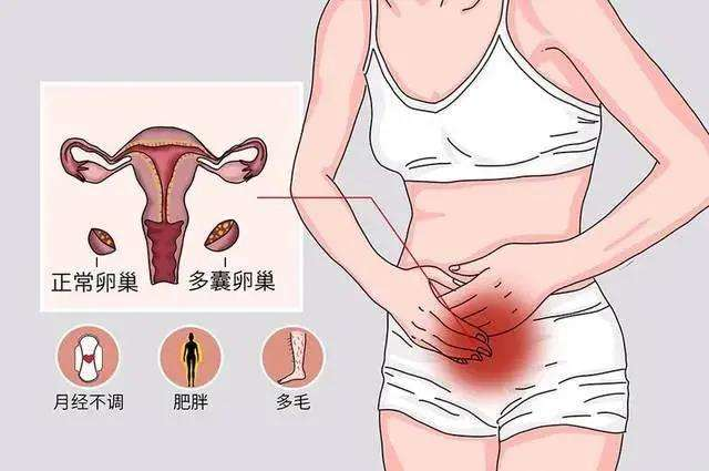 多囊卵巢患者有什么忌口?插图 多囊卵巢患者有什么忌口?插图