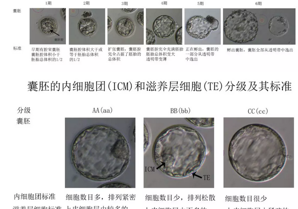 取卵和胚胎培养环节最重要？做试管婴儿的你一定不知道！插图5