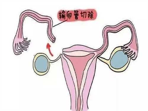 包生男孩的三代试管费用多少？附南昌三代试管包生男孩费用明细！插图