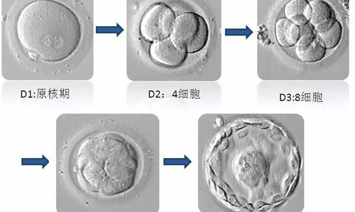 取卵和胚胎培养环节最重要？做试管婴儿的你一定不知道！插图1