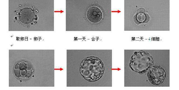 鲜胚囊胚冻胚,移哪个好?关于试管婴儿的那些事儿插图1 鲜胚囊胚冻胚,移哪个好?关于试管婴儿的那些事儿插图1