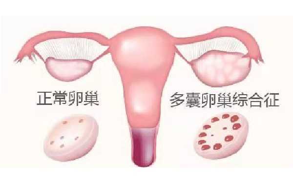 重庆妇幼保健院做试管婴儿费用多少?可以做供卵试管吗插图 重庆妇幼保健院做试管婴儿费用多少?可以做供卵试管吗插图