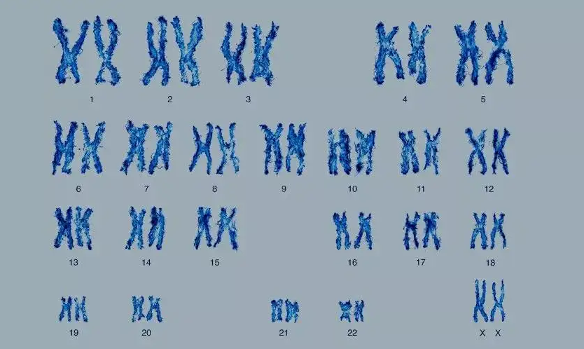 10号染色体异常胎儿还能不能留插图 1658365899299575.png